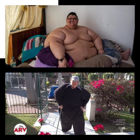 Lelaki Rekod Paling Gemuk 591 Kg Sudah Boleh Berjalan