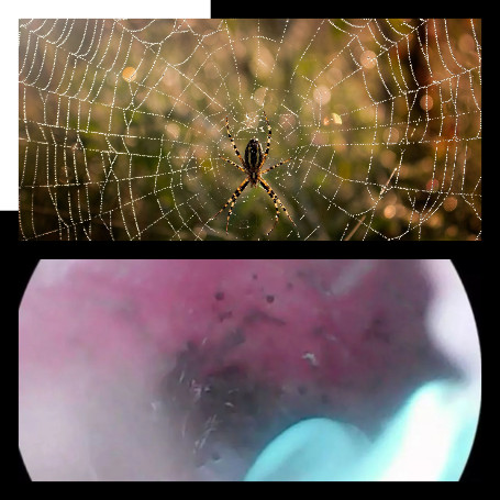 Sarang Labah-Labah Dalam Telinga Guru